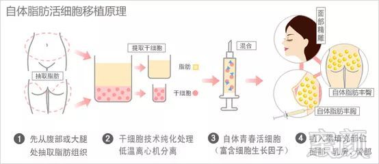 https://img.miyanlife.com/mnt/timg/171105/1506292610-5.jpg