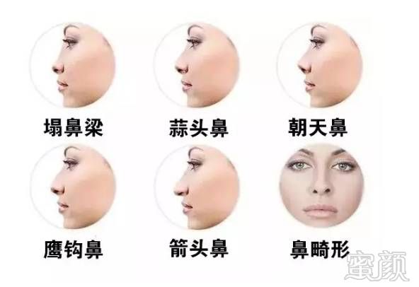 https://img.miyanlife.com/mnt/timg/171106/102T512S-3.jpg