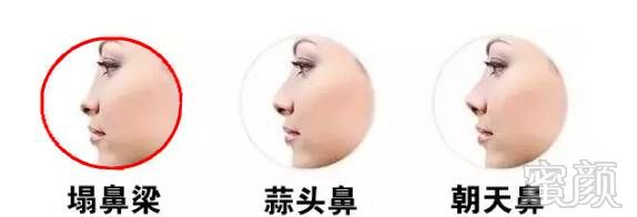 https://img.miyanlife.com/mnt/timg/171106/102T5N22-4.jpg