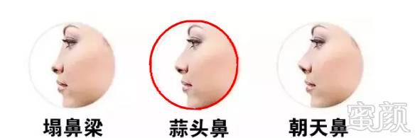 https://img.miyanlife.com/mnt/timg/171106/102T64303-7.jpg