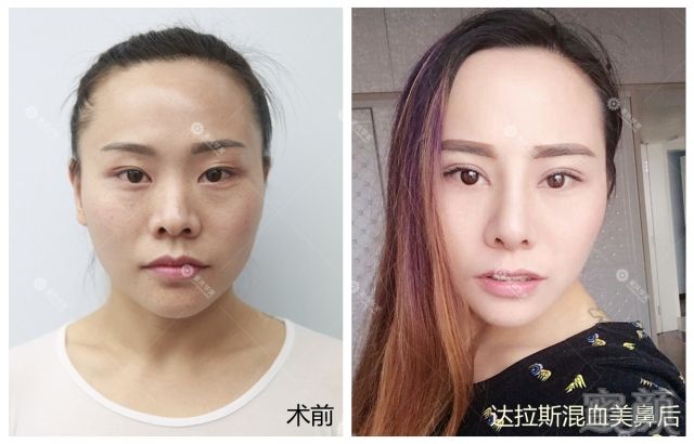 https://img.miyanlife.com/mnt/timg/171106/102TG032-11.jpg