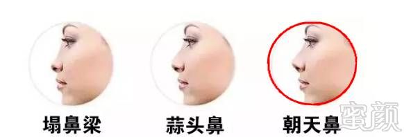 https://img.miyanlife.com/mnt/timg/171106/102TMO3-10.jpg