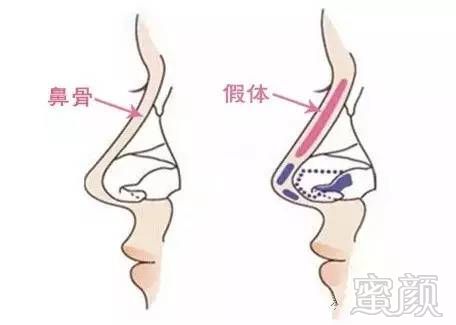 案例图片