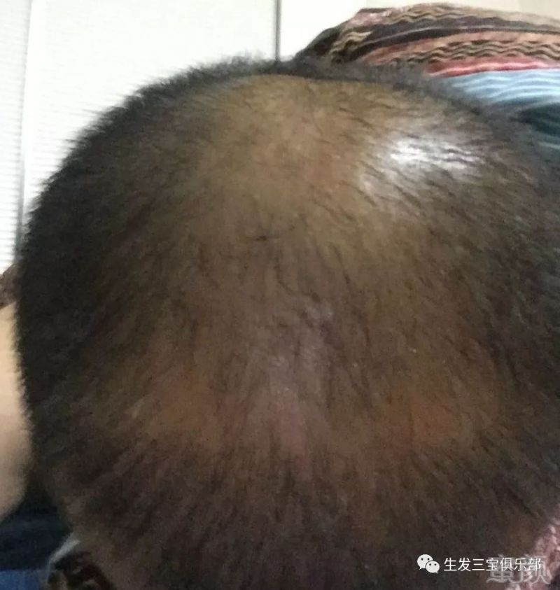 https://img.miyanlife.com/mnt/timg/171106/1115425Q7-3.jpg