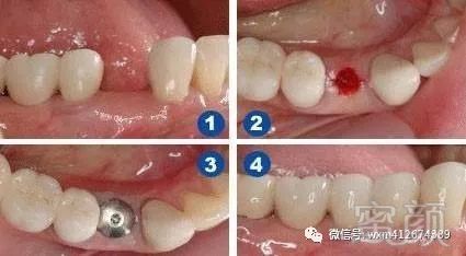 https://img.miyanlife.com/mnt/timg/171106/1149112340-2.jpg