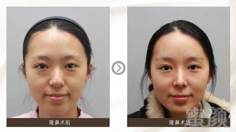 https://img.miyanlife.com/mnt/timg/171106/12091214A-5.jpg