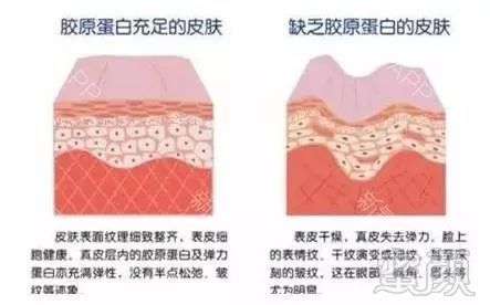 https://img.miyanlife.com/mnt/timg/171106/12593231P-3.jpg