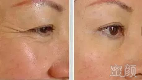 https://img.miyanlife.com/mnt/timg/171106/125Z05N9-8.jpg