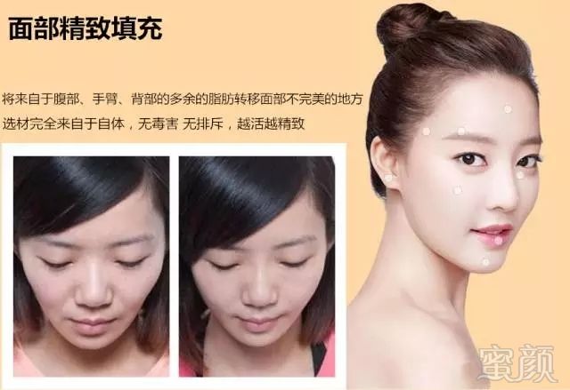 https://img.miyanlife.com/mnt/timg/171106/135514N04-5.jpg