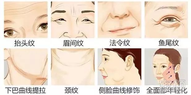 https://img.miyanlife.com/mnt/timg/171107/1051103108-5.jpg