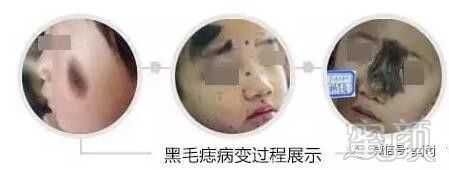 案例图片