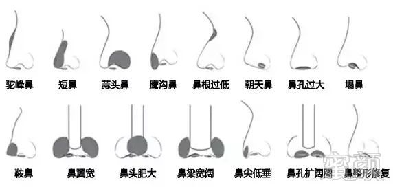 https://img.miyanlife.com/mnt/timg/171107/1131233B6-3.jpg