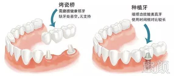 案例图片