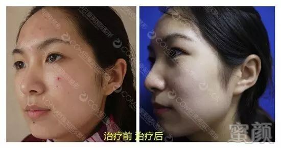 https://img.miyanlife.com/mnt/timg/171107/1309345962-8.jpg