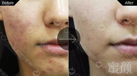 https://img.miyanlife.com/mnt/timg/171107/130935C51-12.jpg