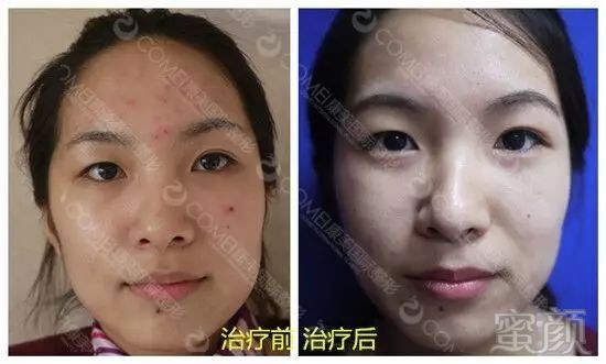 https://img.miyanlife.com/mnt/timg/171107/130935H13-9.jpg