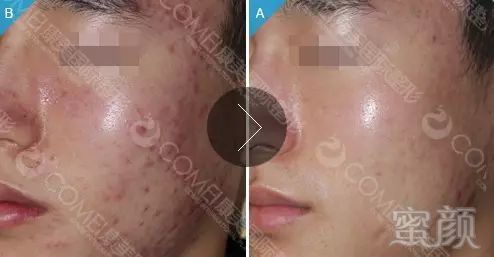 https://img.miyanlife.com/mnt/timg/171107/130935L42-10.jpg