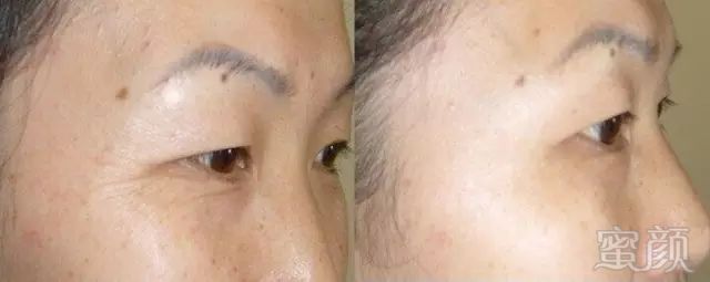https://img.miyanlife.com/mnt/timg/171107/133224H22-5.jpg