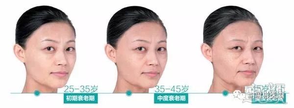 https://img.miyanlife.com/mnt/timg/171108/1103233916-6.jpg