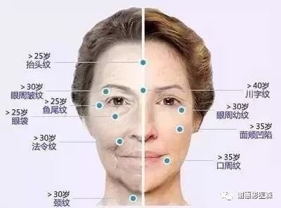 https://img.miyanlife.com/mnt/timg/171108/11032362Z-2.jpg
