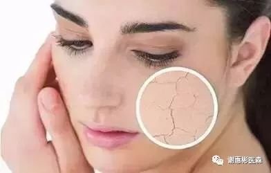 https://img.miyanlife.com/mnt/timg/171108/1103244F7-11.jpg