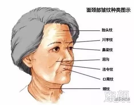 https://img.miyanlife.com/mnt/timg/171108/11033164W-15.jpg