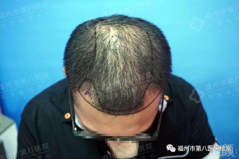 https://img.miyanlife.com/mnt/timg/171108/1129403b3-2.jpg