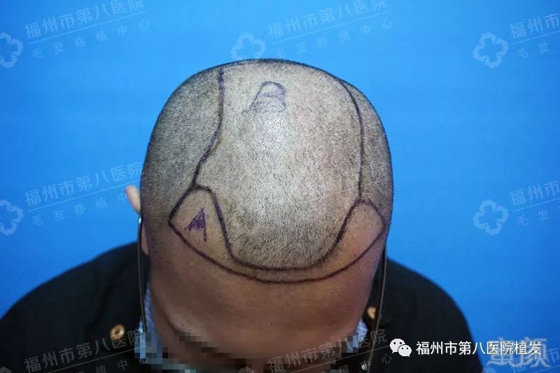 https://img.miyanlife.com/mnt/timg/171108/1129406159-3.jpg