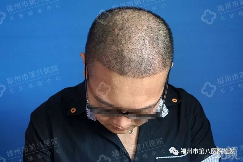 https://img.miyanlife.com/mnt/timg/171108/1129412462-5.jpg