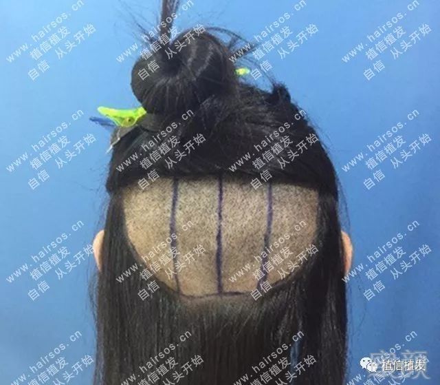 https://img.miyanlife.com/mnt/timg/171108/113QV409-9.jpg