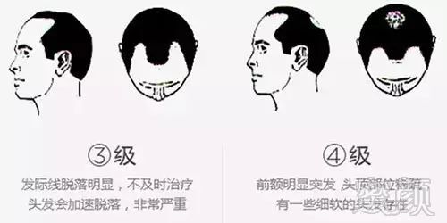 https://img.miyanlife.com/mnt/timg/171108/1142142N4-4.jpg