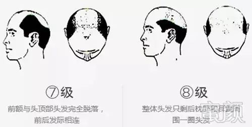 https://img.miyanlife.com/mnt/timg/171108/1142153257-6.jpg