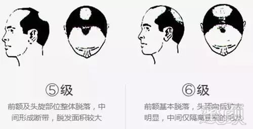 https://img.miyanlife.com/mnt/timg/171108/11421554C-5.jpg