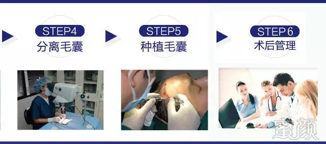 https://img.miyanlife.com/mnt/timg/171108/1142194X3-14.jpg