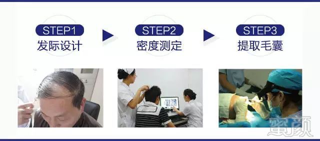 https://img.miyanlife.com/mnt/timg/171108/11421SQ9-13.jpg