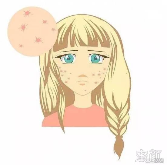 https://img.miyanlife.com/mnt/timg/171108/115H222X-0.jpg