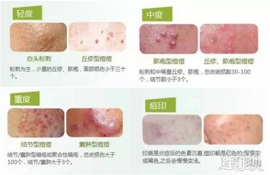 https://img.miyanlife.com/mnt/timg/171108/115H2LZ-1.jpg