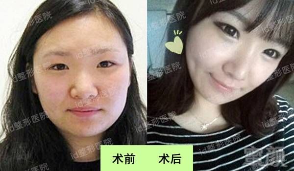 https://img.miyanlife.com/mnt/timg/171108/120151G35-7.jpg