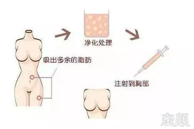 https://img.miyanlife.com/mnt/timg/171108/131321B27-10.jpg
