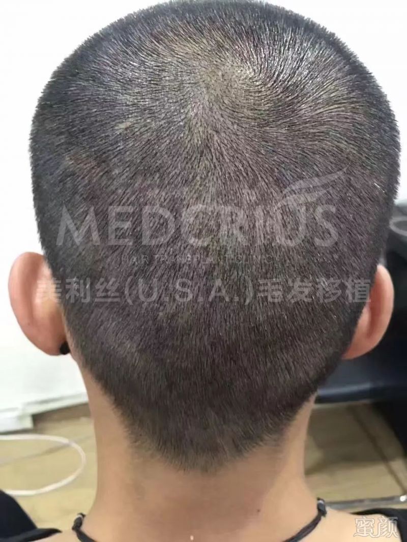 https://img.miyanlife.com/mnt/timg/171108/134503H64-4.jpg