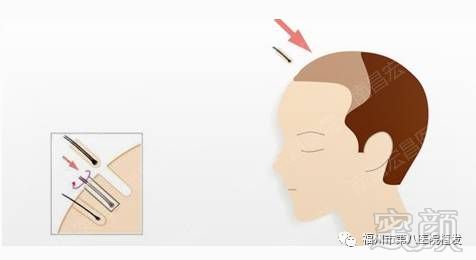 https://img.miyanlife.com/mnt/timg/171108/140R93T8-0.jpg