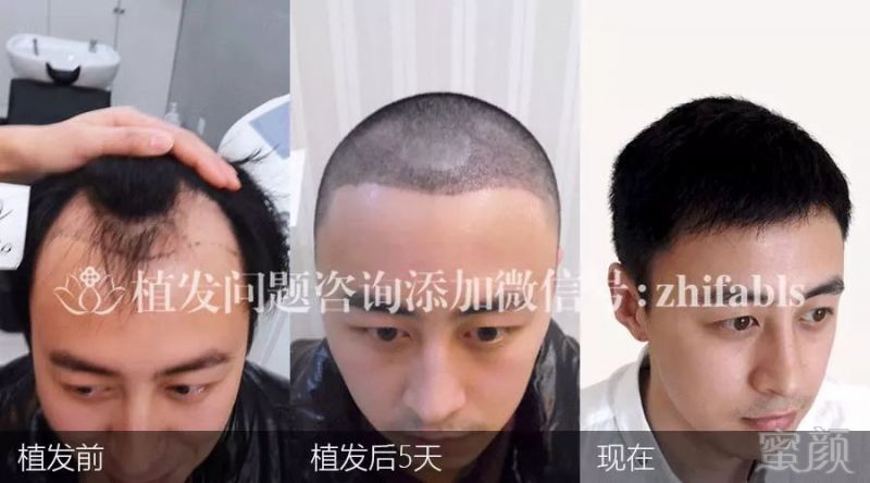 https://img.miyanlife.com/mnt/timg/171109/10424MW8-1.jpg