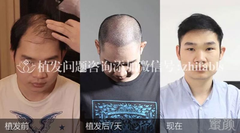 https://img.miyanlife.com/mnt/timg/171109/10424U3U-3.jpg