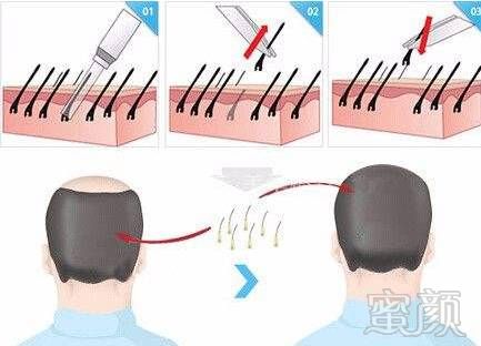 https://img.miyanlife.com/mnt/timg/171109/10432U636-0.jpg
