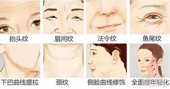 https://img.miyanlife.com/mnt/timg/171109/10563V110-5.jpg