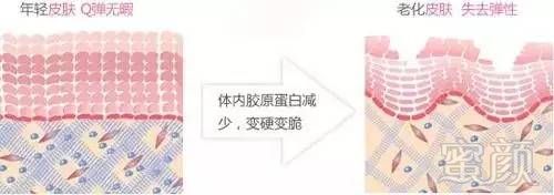 https://img.miyanlife.com/mnt/timg/171109/1119312164-7.jpg