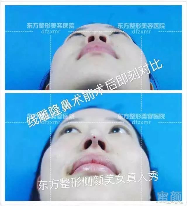 https://img.miyanlife.com/mnt/timg/171109/111S91404-6.jpg