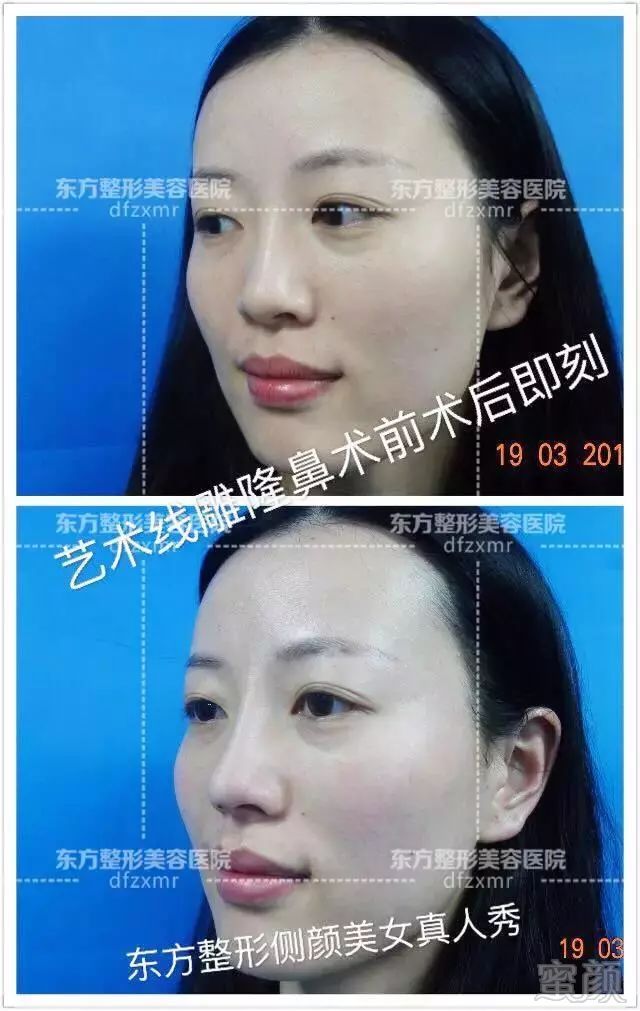 https://img.miyanlife.com/mnt/timg/171109/111T03045-9.jpg