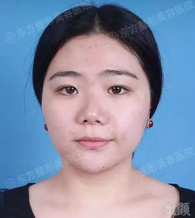 https://img.miyanlife.com/mnt/timg/171109/111T0K30-11.jpg