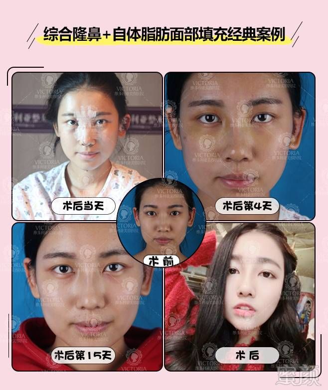 https://img.miyanlife.com/mnt/timg/171109/111U21212-14.jpg